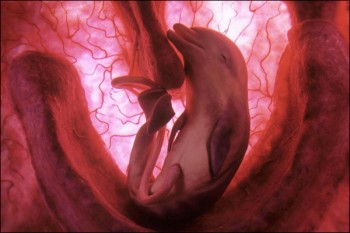 foetusdauphin